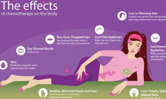 Best advice during chemo for and by you